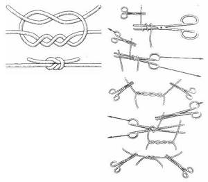 Surgical knot