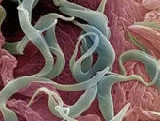 Паразиты попадают в организм в виде личинок, а затем развиваются в виде червей